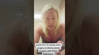 Botched plastic surgery at Divine plastic surgery miami florida with Pablo baltodano [upl. by Troc]