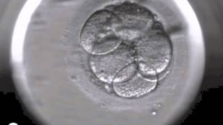 Embryoscope timelapse DanFertdk [upl. by Noivert109]