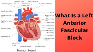 What Is a Left Anterior Fascicular Block [upl. by Ecille]