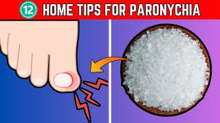 12 Essential Home Tips for Treating Paronychia A Comprehensive Guide  The Health Place [upl. by Steffin517]