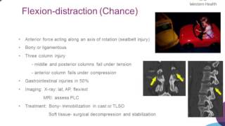 Thoracolumbar Spine Trauma by Dr Amy Gibbens [upl. by Asertal845]