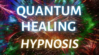 Accessing Higher Wisdom Quantum Healing Hypnosis Session [upl. by Dabbs905]