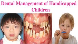 Dental Management of Handicapped Children dental bridge threaders [upl. by Yartnoed]