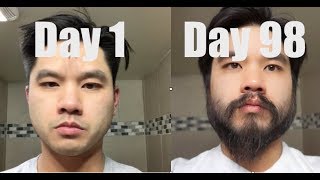 I Grew Out My Beard For 3 Months Using Minoxidil Rogaine [upl. by Ayotas]