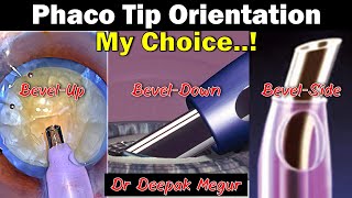 Phaco BasicsPhaco Tip Orientation Bevel Up Bevel down My preference  Dr Deepak Megur [upl. by Sennahoj]