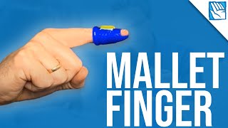 Cant Lift Your Fingertip   Mallet Finger Recovery  Part 2 [upl. by Anair]