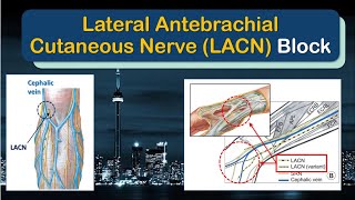 LATERAL ANTEBRACHIAL CUTANEOUS NERVE Block  A quotHowToquot Guide [upl. by Brick801]