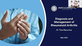 Diagnosis and management of Rheumatoid Arthritis [upl. by Nalro]