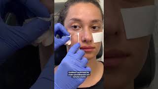 The Secret to Banishing Under Eye Circles shortvideo [upl. by Rebba]