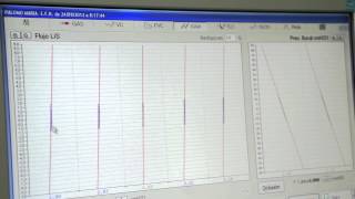 Volúmenes Pulmonares por Pletismografía corporal Prueba [upl. by Jess111]