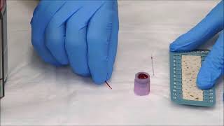 How to Measure the Hematocrit [upl. by Atineg342]