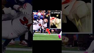 Doctor explains Jordan Mason shoulder injury in 60 seconds 49ers fantasyfootball medical anatomy [upl. by Pauiie34]