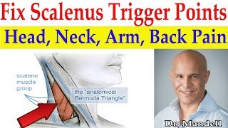 Fix Scalenus Trigger Points Quick Relief to Head Neck Arm Upper Back Pain  Dr Alan Mandell DC [upl. by Dami4]