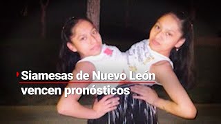 SIAMESAS QUINCEAÑERAS  Lupita y Elsa vencen los pronósticos médicos [upl. by Nyleikcaj]