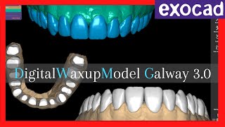 Digital Waxup Model exocad Galway 30 Encerado Digital💥 [upl. by Ayet]