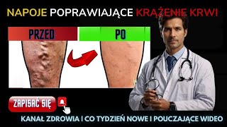 5 najlepszych napojów poprawiających krążenie krwizdrowie porady na temat zdrowia [upl. by Breed361]