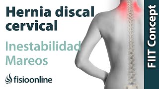 ¿Puede una hernia discal cervical provocar mareos e inestabilidad [upl. by Atteinotna423]