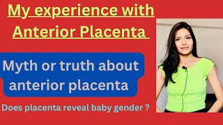 My experience with Anterior placentaAnterior Placenta complications and baby gender [upl. by Yesdnik569]