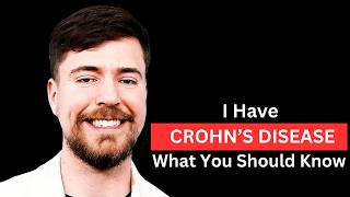 What You Need to Know About Crohn’s Disease  Mr Beast [upl. by Elinore]