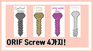 수술용 Screw 40초 안에 구분하기 cortical screw locking screw locking cannulated screw cannulated screw [upl. by Zink360]