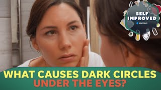 A Dermatologist reveals why you get dark circles under your eyes  SELF IMPROVED [upl. by Gasser]