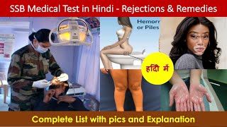 SSB Medical Examination in Hindi  Rejections and Remedies [upl. by Conner]