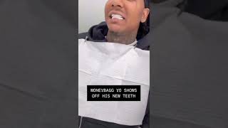 Moneybagg Yo shows off his new teeth [upl. by Rosdniw]