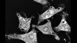 Macrophages from mice engulfing E coli [upl. by Singband]