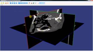 3DimViewer Chapter 4 Measurement [upl. by Llemhar195]