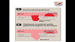 fibrinolytic drugs  blood5 [upl. by Nnairahs]