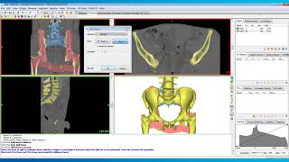 How to Use Split Mask in Mimics  Mimics Innovation Suite  Materialise Medical [upl. by Eidua]