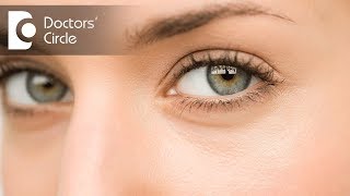 How to treat dark circles  Dr Priyanka Dasari Reddy [upl. by Tenom917]