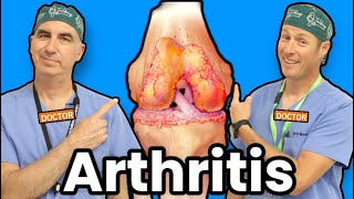 Treating Knee Arthritis Without Surgery [upl. by Eatnhoj]