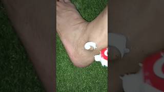 Feet Whitening Tips feet spots pigmentation Blackheads clearning viralvideo feetwhiteningtips [upl. by Akelahs460]