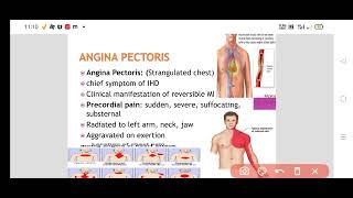 What is Angina Pectoris Types of Angina Pathophysiology of angina [upl. by Allac]