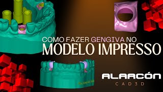 COMO FAZER GENGIVA NO MODELO IMPRESSO fluxodigital exocad [upl. by Drew]