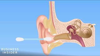 Forget QTips — Here’s How You Should Be Cleaning Your Ears [upl. by Ayana]