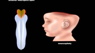 USMLE® Step 1 Neuroscience Development of CNS Animation [upl. by Novyad891]