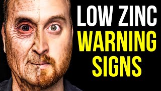 10 Signs of Zinc Deficiency To Never Ignore [upl. by Novek]