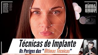 As Últimas Técnicas de Implantes Podem Ser As Piores  Entenda Para Não Ser Cobaia Sem Saber [upl. by Niltyak]