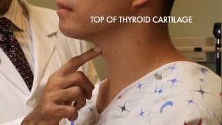 The Thyroid Exam Stanford Medicine 25 [upl. by Eicul]