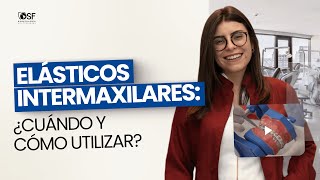 ELÁSTICOS INTERMAXILARES ¿Cuándo y cómo utilizar [upl. by Ozkum]