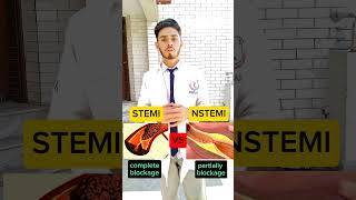 STEMI VS NSTEMI heart attack concept viral doctor education [upl. by Hcahsem]