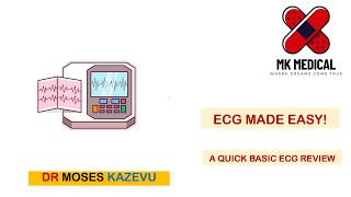 ECG made easy [upl. by Ribaj]