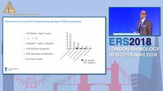 ERS London 2018 Occult CSF Leaks After Endoscopic Sinus Surgery Michael Soyka [upl. by Akehsar]