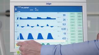 Einstellen der Beatmung bei der der Dräger Evita Infinity V500 [upl. by Hyacintha]