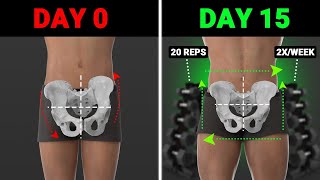 The Best Weight Training Exercises To Fix Lateral Pelvic Tilt asymmetrical hips [upl. by Aisirtap191]