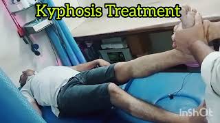 kyphosis Treatment  Chiropractor Treatment  DrRavi kumar  7678369727 [upl. by Arihsat102]