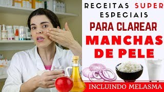 Acabe com as MANCHAS NA PELE inclusive MELASMA  Receita Caseira [upl. by Janene981]