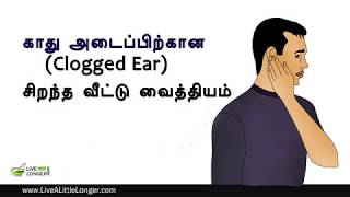 காது அடைப்பிற்கான சிறந்த வீட்டு வைத்தியம்  Home Remedies For Clogged Ears [upl. by Okiam]